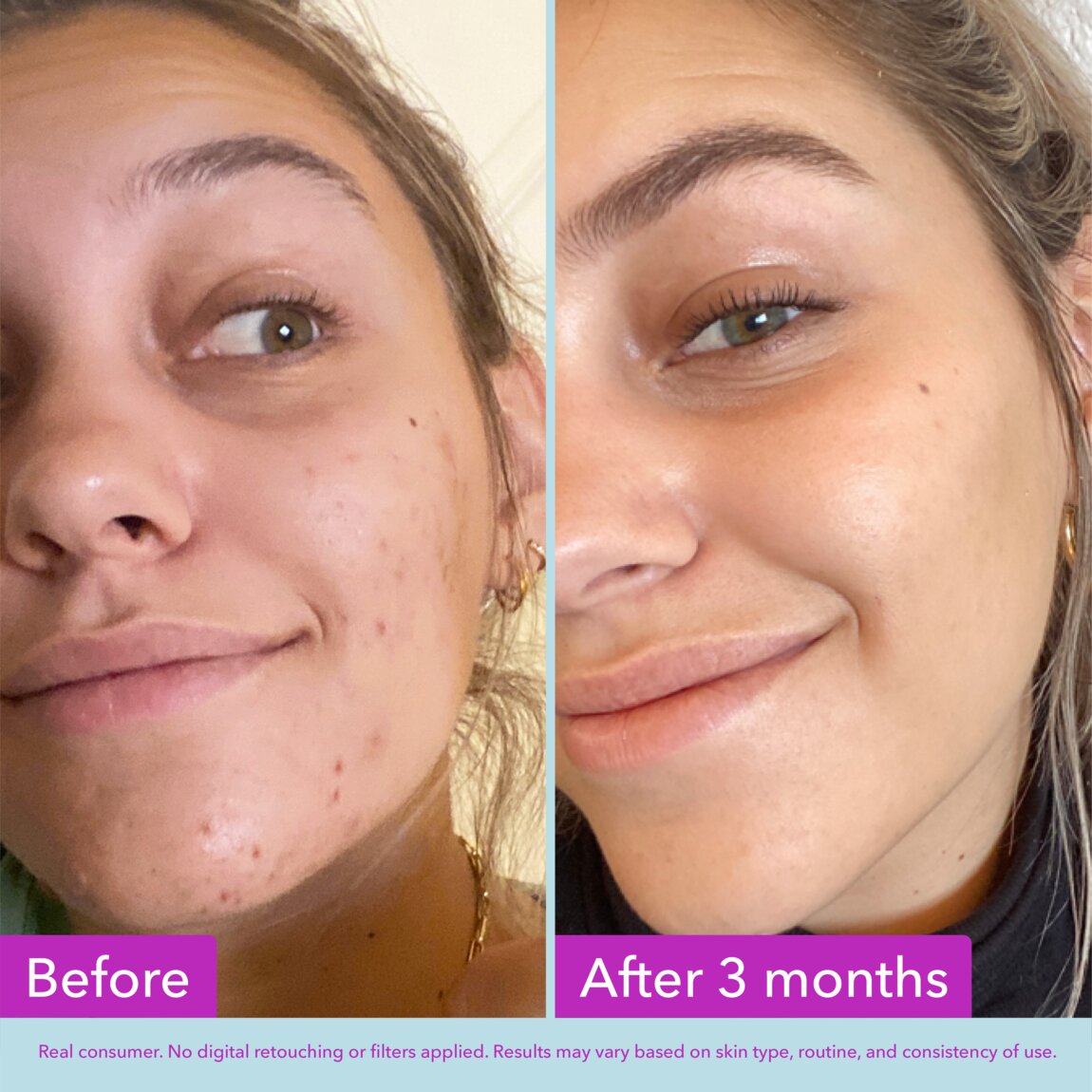 niacinamide-brightening-toner-i4 zb_p.jpg