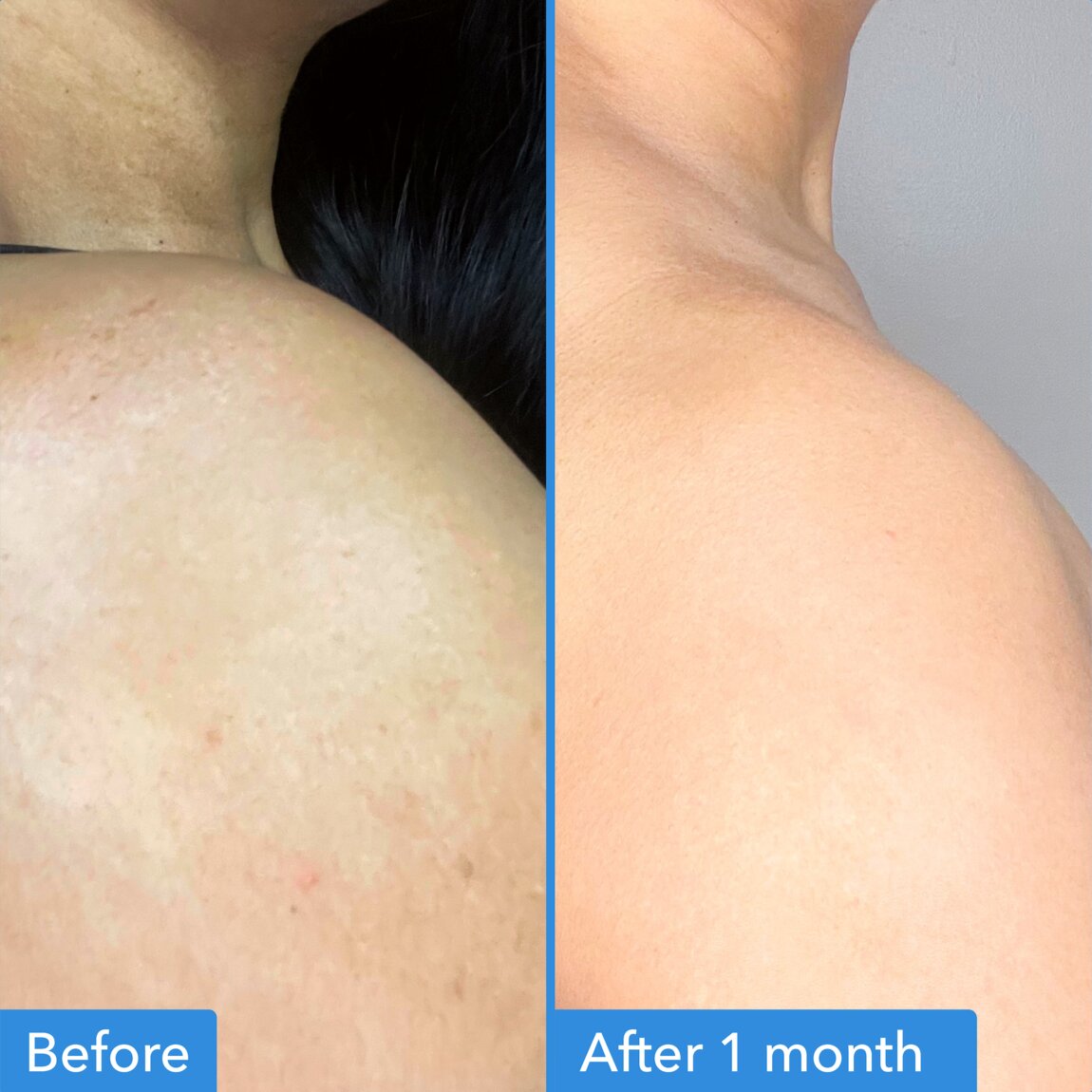 discoloration-correcting-body-treatment-c7 zb_p.jpg